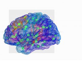 Cérebro virtual ajuda a decifrar a epilepsia