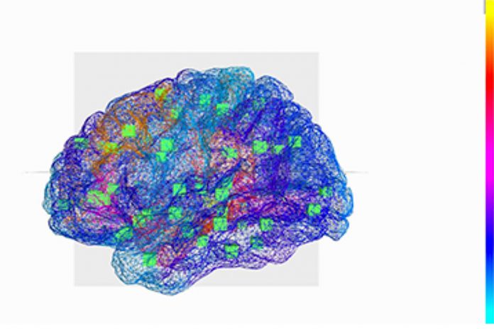 Cérebro virtual ajuda a decifrar a epilepsia