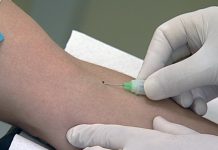 Teste de sangue pode prever gravidade da COVID-19