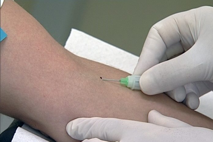 Análises ao sangue podem monitorar o cancro do cólon Análises ao sangue podem monitorar o cancro do cólon
