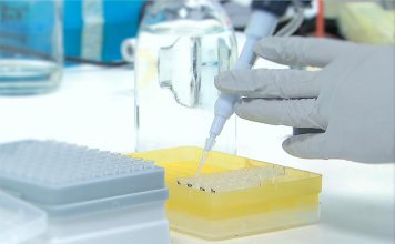 Teste à urina é melhor que ressonância magnética para monitorar cancro da próstata de baixo risco