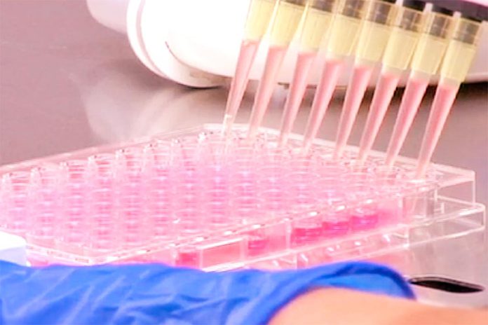 Primeiro teste de sangue para cancro da cabeça e pescoço é uma história de sucesso Primeiro teste de sangue para cancro da cabeça e pescoço é uma história de sucesso