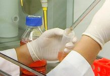 Mutações do coronavírus podem ocorrer em pacientes de COVID-19 crónica Mutações do coronavírus podem ocorrer em pacientes de COVID-19 crónica