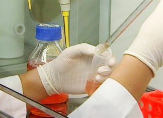 Fibrose renal pode vir a ser diagnosticada precocemente por testes não invasivos