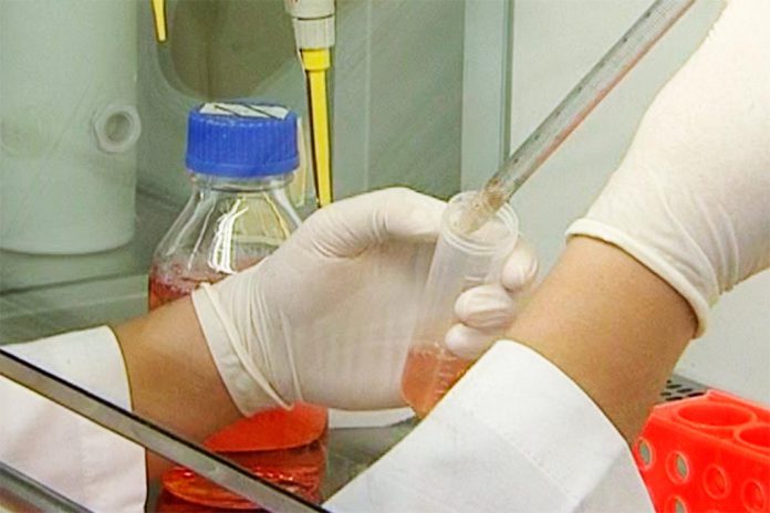 Fibrose renal pode vir a ser diagnosticada precocemente por testes não invasivos Fibrose renal pode vir a ser diagnosticada precocemente por testes não invasivos