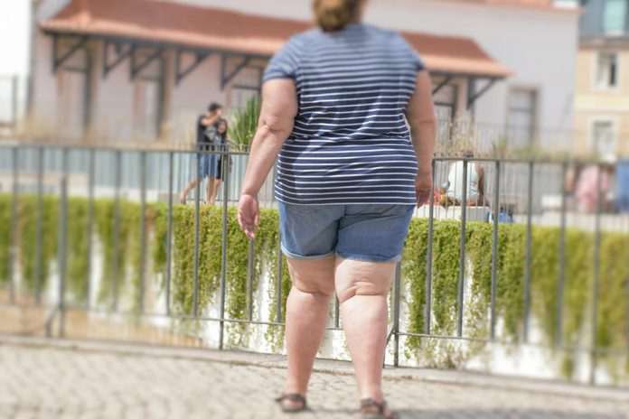 Obesidade aumenta risco de AVC