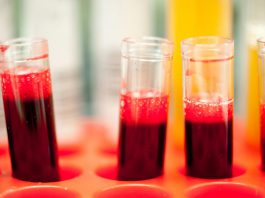 Exame de sangue