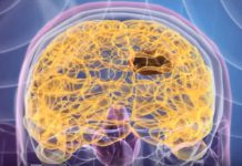 NanoTherm, tratamento dos tumores sólidos cerebrais