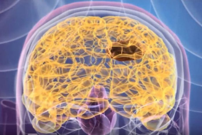 NanoTherm, tratamento dos tumores sólidos cerebrais
