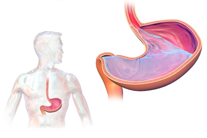 Doença do refluxo ácido e gastroesofágico