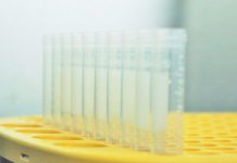 Novo teste à COVID-19 da Unilabs identifica variante Delta