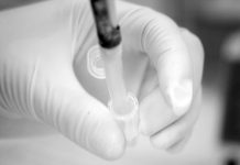 Teste de laboratório ao coronavírus não garante eficácia do diagnóstico