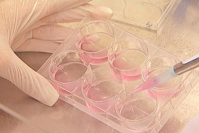 COVID-19: Testes serológicos para conhecer taxa real de infeção de uma população COVID-19: Testes serológicos para conhecer taxa real de infeção de uma população