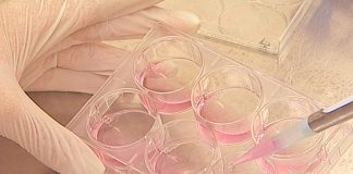 Novo tratamento para cancro de pulmão de pequenas células
