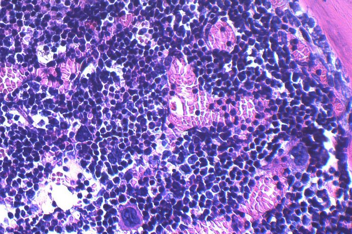 Imagem microscópica que destaca os efeitos perniciosos da obesidade na saúde a longo prazo nas células estaminais hematopoiéticas