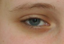 Cuidados na saúde visual das crianças indigna Optometristas