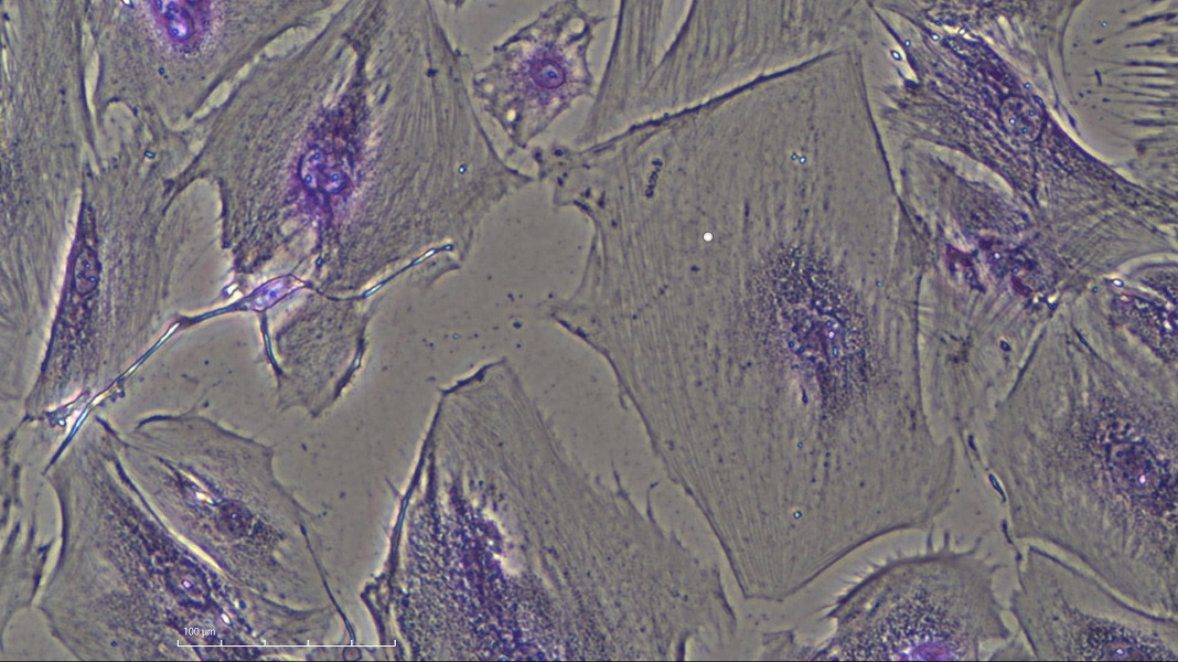 Células tipo estaminal para aplicação na Medicina Dentária Regenerativa