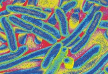 Bactérias E. coli coloridas em gradiente de calor