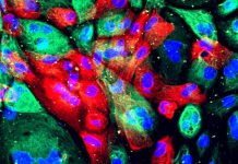 Células de próstata humana de um organoide (uma construção artificial que se assemelha a um órgão). Essas células vieram de um xenoenxerto onde servem como controlo para o estudo de células tumorais primárias de cancro da próstata, que também são injetadas em ratos e depois extraídas para caracterização