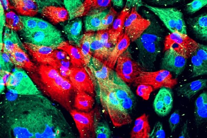 Células de próstata humana de um organoide (uma construção artificial que se assemelha a um órgão). Essas células vieram de um xenoenxerto onde servem como controlo para o estudo de células tumorais primárias de cancro da próstata, que também são injetadas em ratos e depois extraídas para caracterização