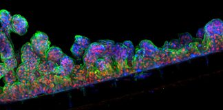 Revestimento intestinal humano criado em chip orgânico