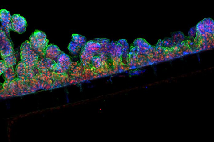 Revestimento intestinal humano criado em chip orgânico