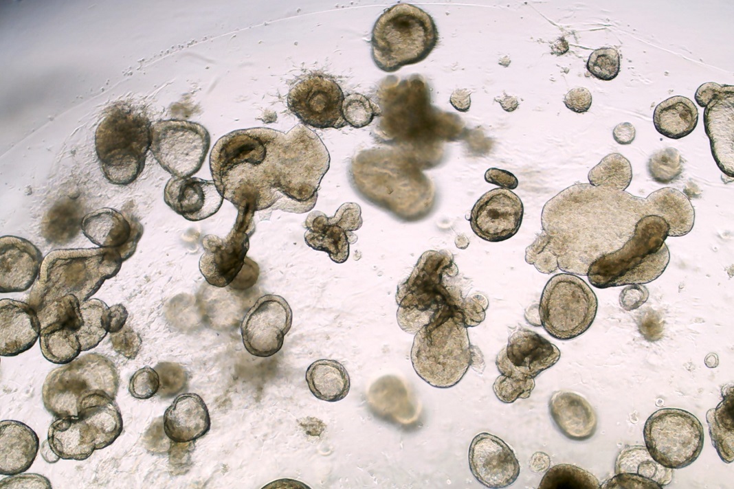 Versões em miniatura de um revestimento intestinal humano, conhecidos como organoides, foram gerados usando o conhecimento sobre células estaminais pluripotentes induzidas, ou iPSCs, em Cedars-Sinai. Cada célula dos organoides possuí a impressão digital genética e as características únicas de um indivíduo. 