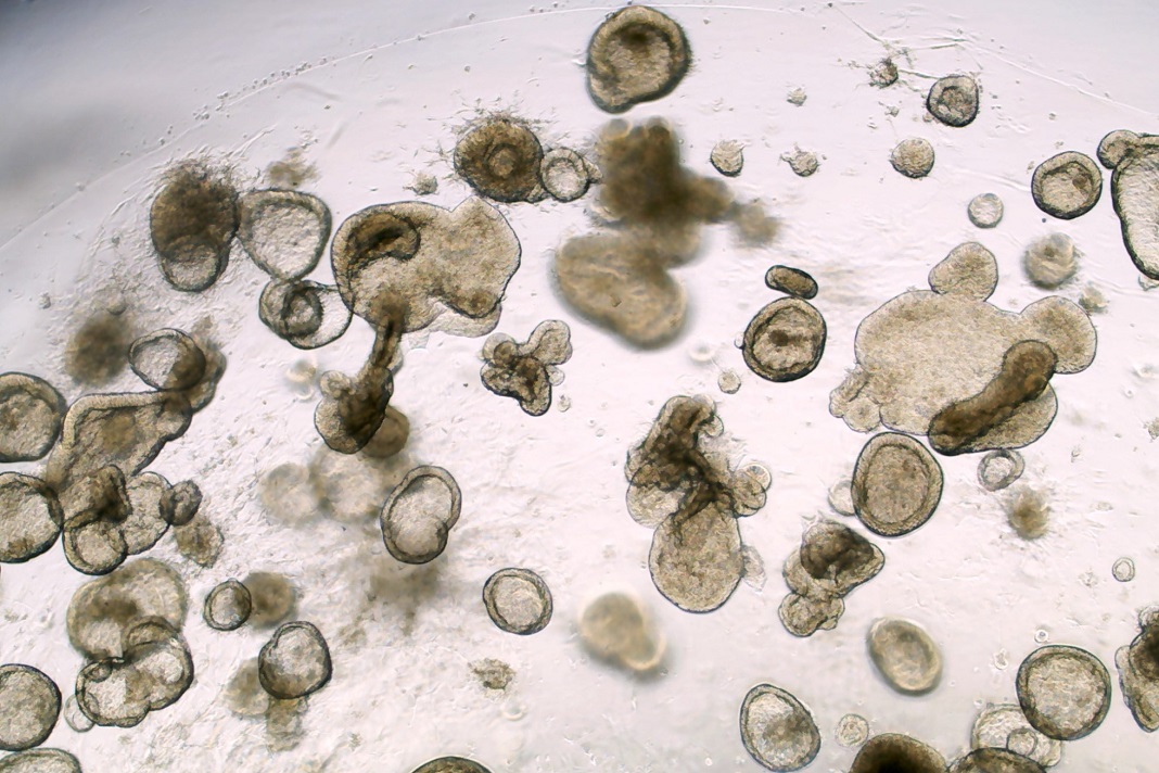 Versões em miniatura de um revestimento intestinal humano, conhecidos como organoides, foram gerados usando o conhecimento sobre células estaminais pluripotentes induzidas, ou iPSCs, em Cedars-Sinai. Cada célula dos organoides possuí a impressão digital genética e as características únicas de um indivíduo.