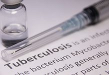 Novo exame de sangue deteta tuberculose até dois anos de se manifestar