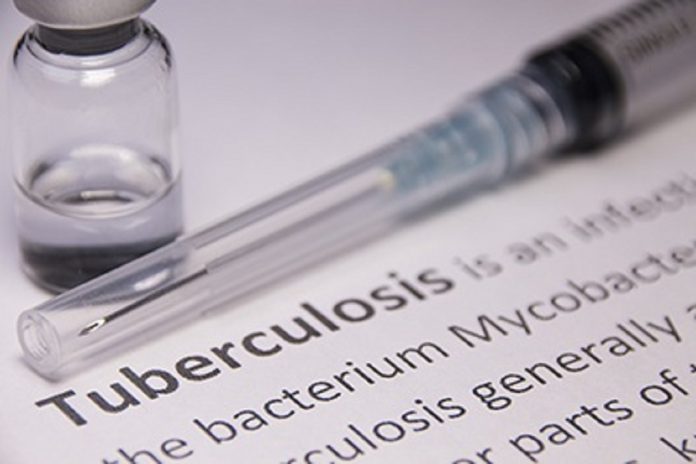 Novo exame de sangue deteta tuberculose até dois anos de se manifestar