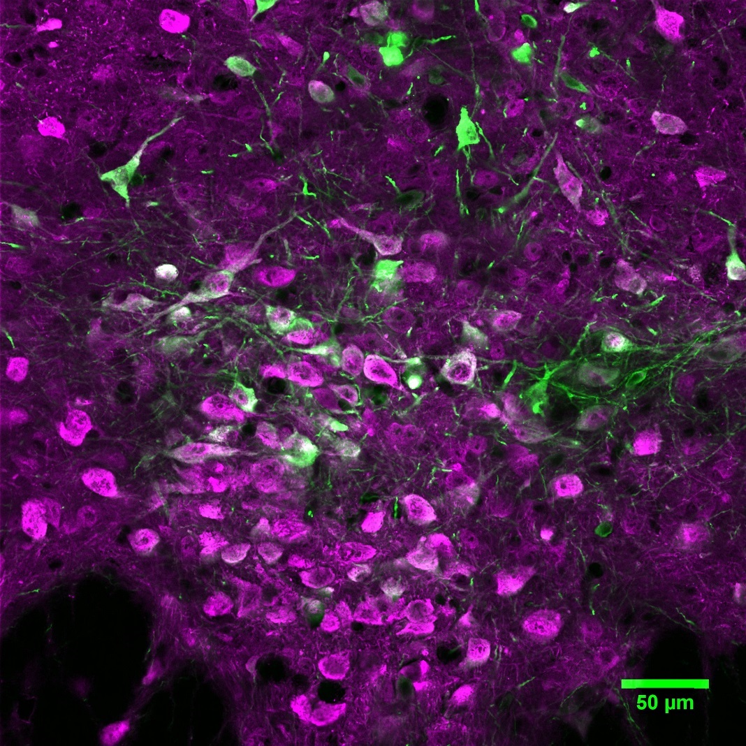 Microfotografia de neurónios produtores de serotonina (a cor-de-rosa) no cérebro do ratinho