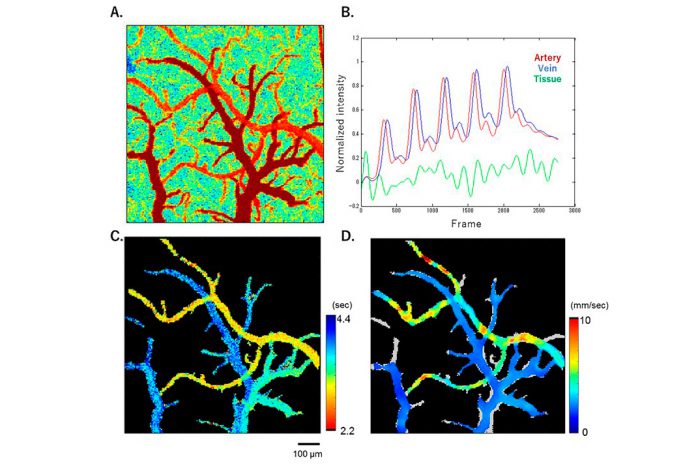 Vasculatura extraída da superfície do cérebro do rato usando uma análise de correlação cruzada de mudanças de tempo-intensidade em sinais fluorescentes. B. Resultados típicos para mudanças de tempo-intensidade medidas de intensidade de pixel calculadas sobre as áreas das artérias (vermelho), veia (azul) e tecido (verde). C. Um mapa do tempo de trânsito de corantes fluorescentes em cada pixel. D. Mapa da velocidade calculada do fluxo sanguíneo. Vasculatura extraída da superfície do cérebro do rato usando uma análise de correlação cruzada de mudanças de tempo-intensidade em sinais fluorescentes. B. Resultados típicos para mudanças de tempo-intensidade medidas de intensidade de pixel calculadas sobre as áreas das artérias (vermelho), veia (azul) e tecido (verde). C. Um mapa do tempo de trânsito de corantes fluorescentes em cada pixel. D. Mapa da velocidade calculada do fluxo sanguíneo.