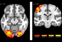 Aprendizagem é afetada pela duração e frequência do treino