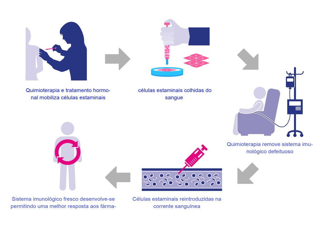 Transplante de células estaminais no tratamento da doença de Crohn