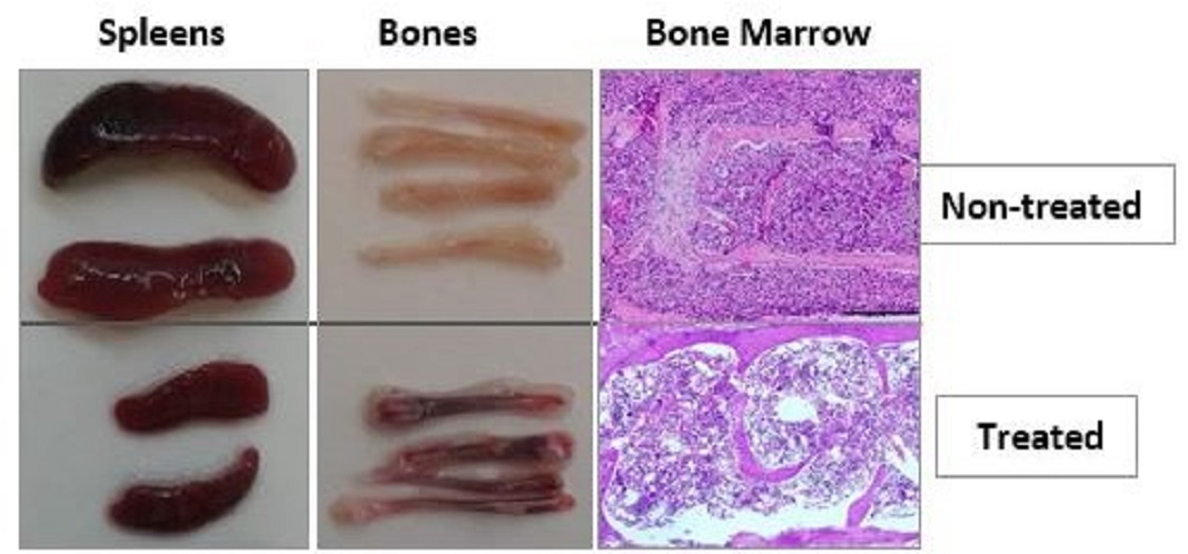 Células cancerosas de leucemia antes e depois do tratamento com o novo medicamentos.
