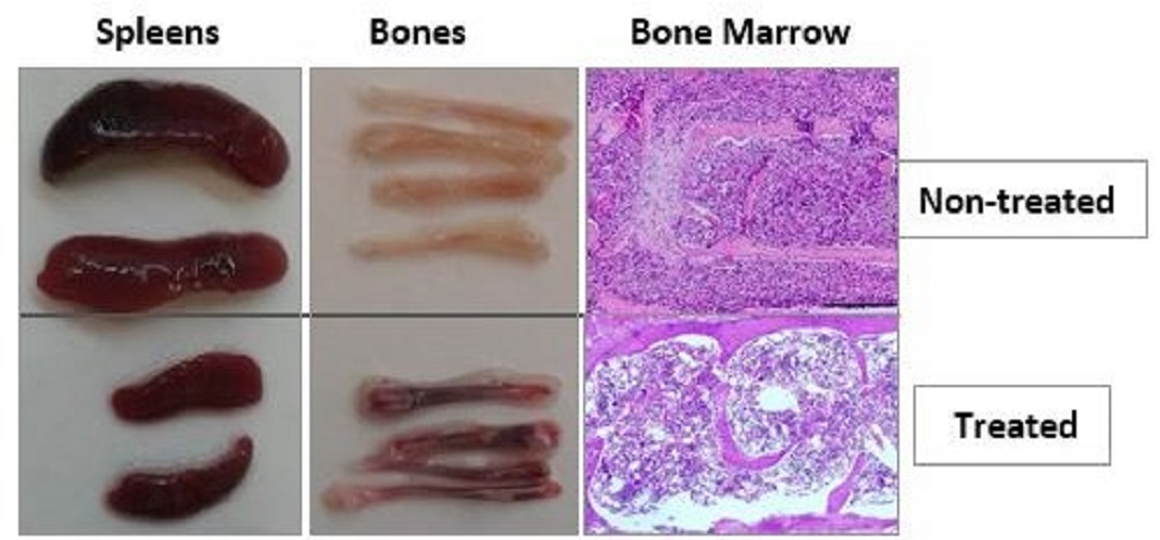 Células cancerosas de leucemia antes e depois do tratamento com o novo medicamentos. 