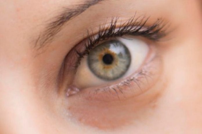 Lente de contacto inteligente diagnostica e trata o glaucoma