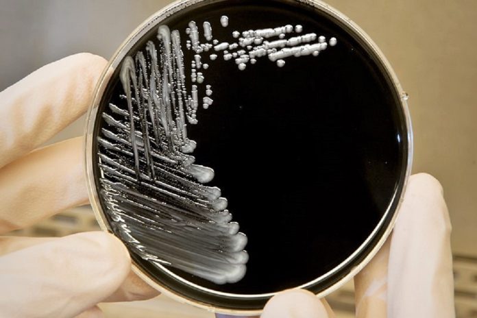 Legionella no Hospital CUF Descobertas sobe para 13 os infetados