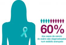 Cancro do ovário é diagnosticado numa fase avançada, alerta a LPC