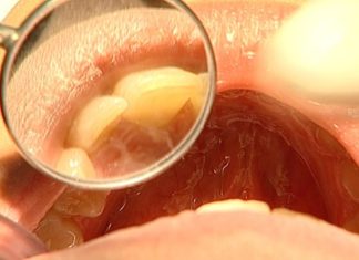 Manter aparelhos dentários em perfeitas condições e garantir a higiene oral Manter aparelhos dentários em perfeitas condições e garantir a higiene oral