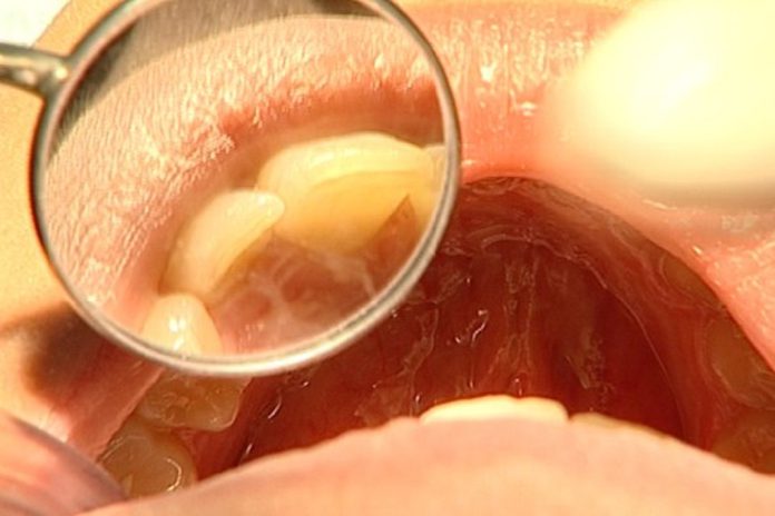 Dentistas alertam para promessas de tratamentos milagrosos