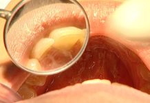 Impacto do fumo passivo na saúde oral e sistema respiratório