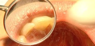 Impacto do fumo passivo na saúde oral e sistema respiratório