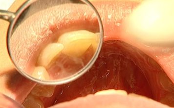 Impacto do fumo passivo na saúde oral e sistema respiratório