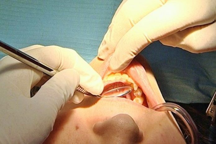 Perda dentária tem diversas implicações incluindo na nutrição em idosos