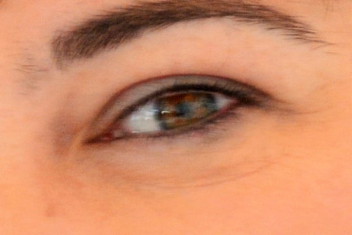 Os riscos de desenvolver glaucoma