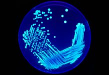 Legionella no Hospital CUF Descobertas sobe para seis os doentes infetados