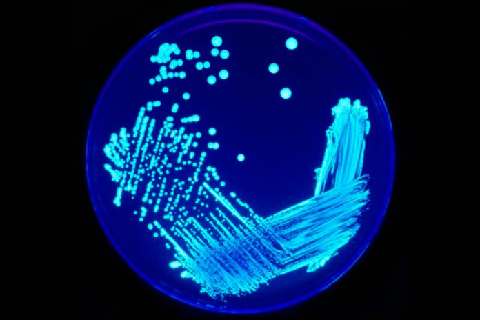 Legionella no Hospital CUF Descobertas sobe para seis os doentes infetados