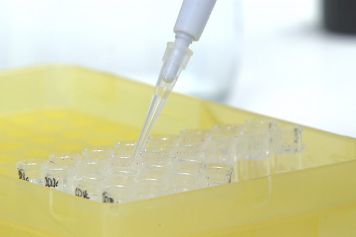 Novo teste RT-PCR para a COVID-19 usa a saliva