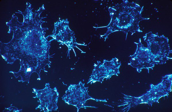 Descoberta de mutações em células cancerígenas permite melhor tratamento do cancro